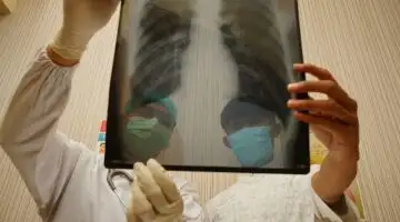 Médico mostra ao paciente imagens de tomografia dos pulmões