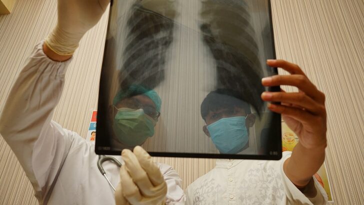 Médico mostra ao paciente imagens de tomografia dos pulmões